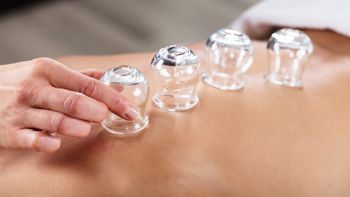 Cupping massage